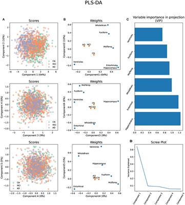 Sex Differences in the Metabolome of Alzheimer's Disease Progression